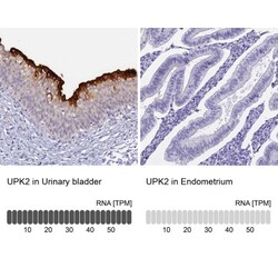 Uroplakin II Antibody, Novus Biologicals:Antibodies:Primary Antibodies